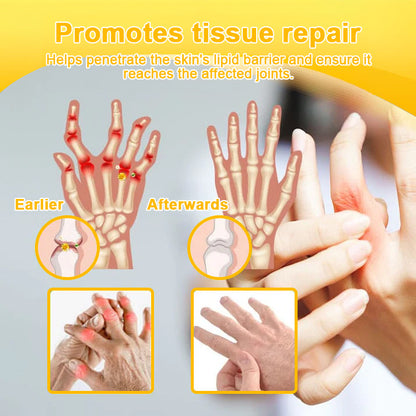 ADNOON® Botulinum Toxin &amp; Bee Venom Pain-Relief Bone Healing Cream