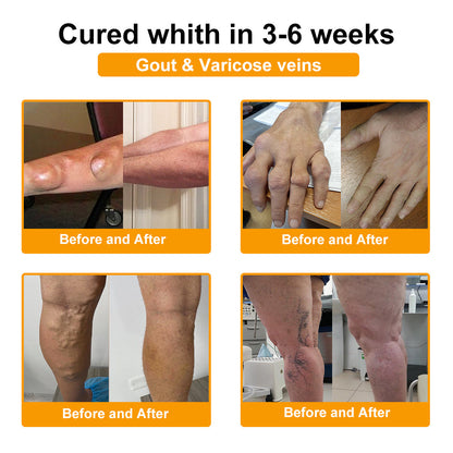 ADNOON® Botulinum Toxin &amp; Bee Venom Pain-Relief Bone Healing Cream