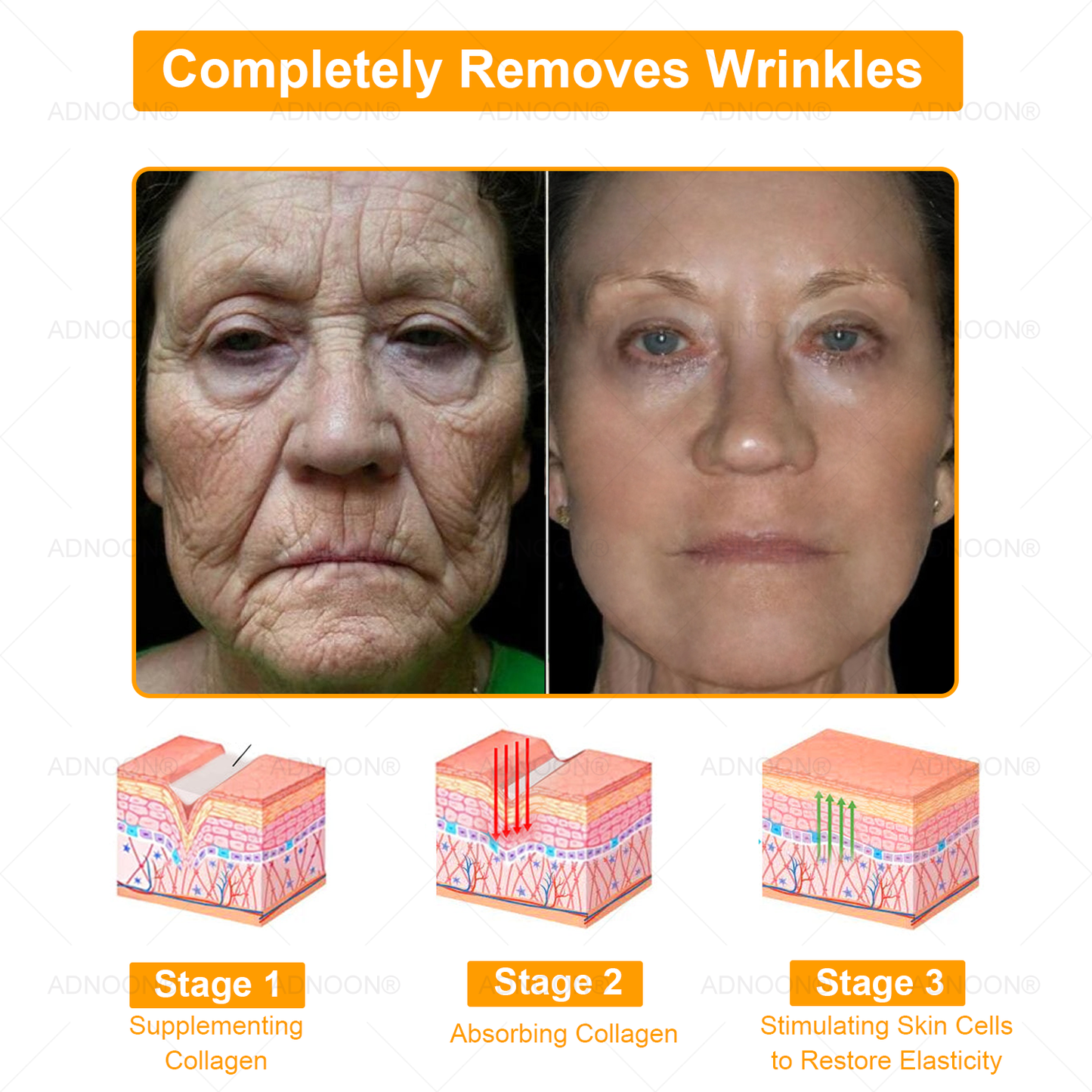 ADNOON® 7 Day Quick Skin Repair Cream