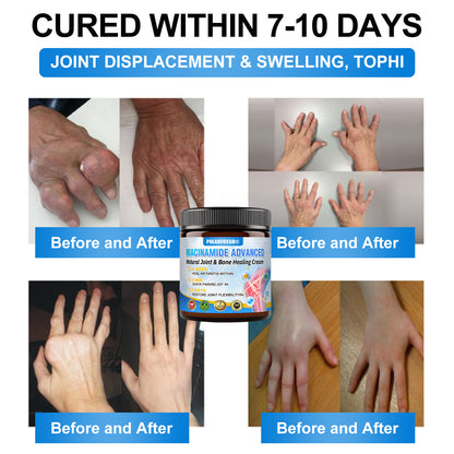 POLARFRESH® Niacinamide Advanced Natural Joint & Bone Healing Cream👨‍⚕️ Approved by the FDA