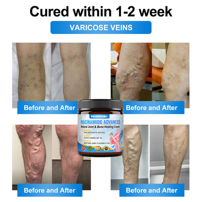POLARFRESH® Niacinamide Advanced Natural Joint & Bone Healing Cream👨‍⚕️ Approved by the FDA