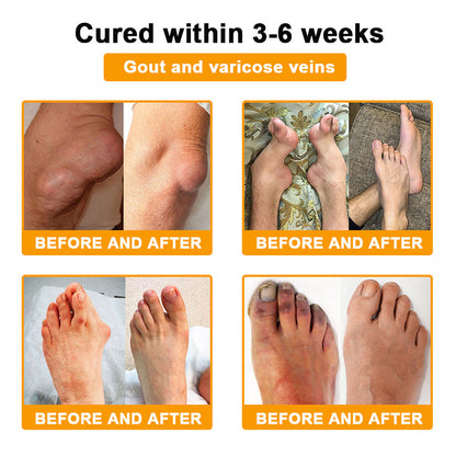 ADNOON® Botulinum Toxin &amp; Bee Venom Pain-Relief Bone Healing Cream
