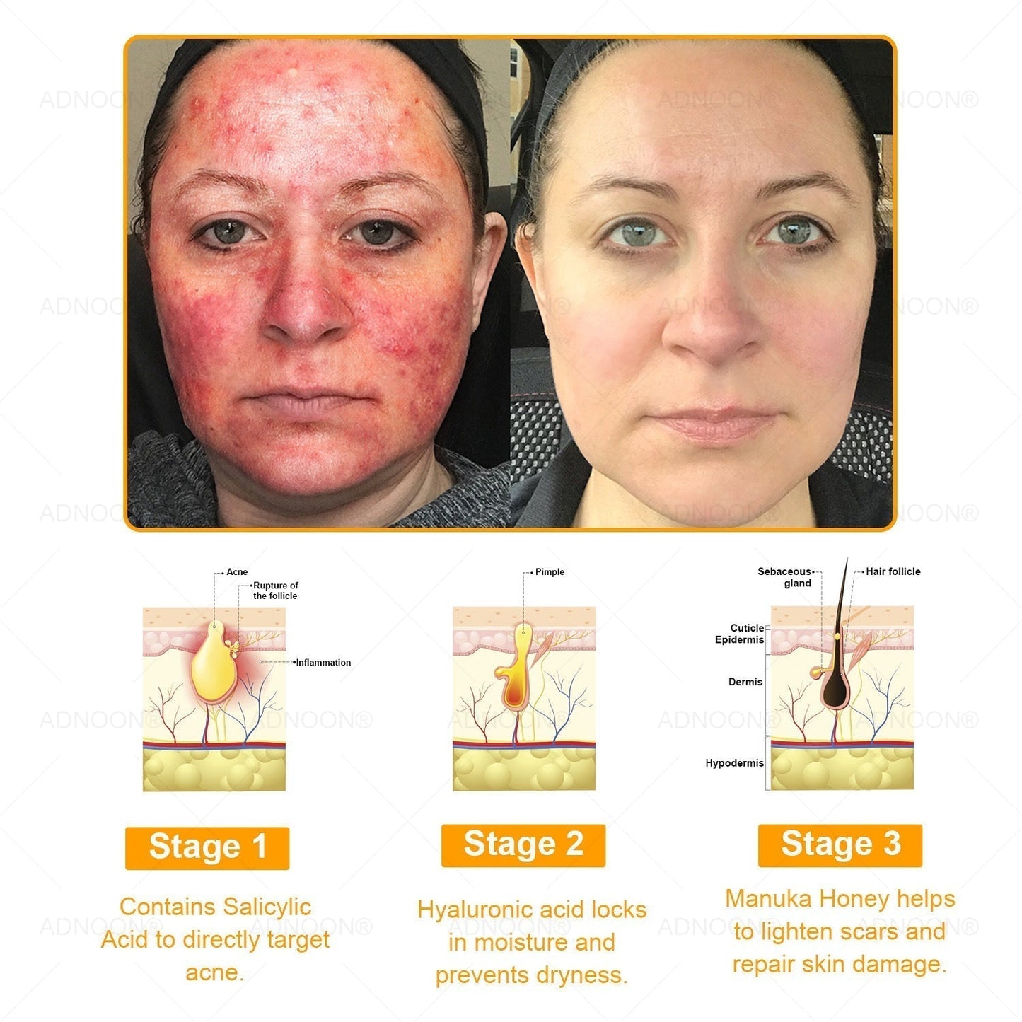 ADNOON® 7 Day Quick Skin Repair Cream