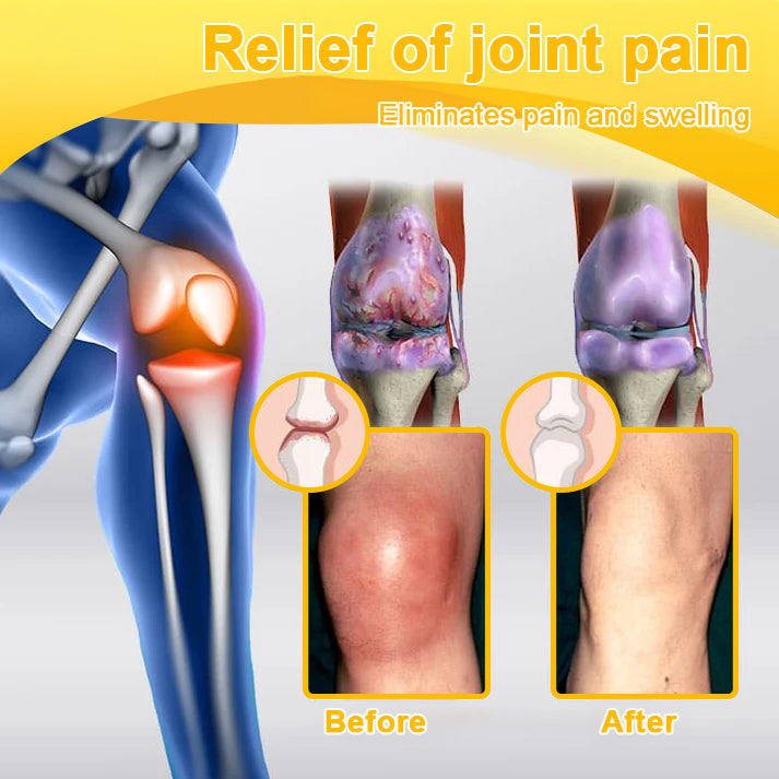 ADNOON® Botulinum Toxin &amp; Bee Venom Pain-Relief Bone Healing Cream